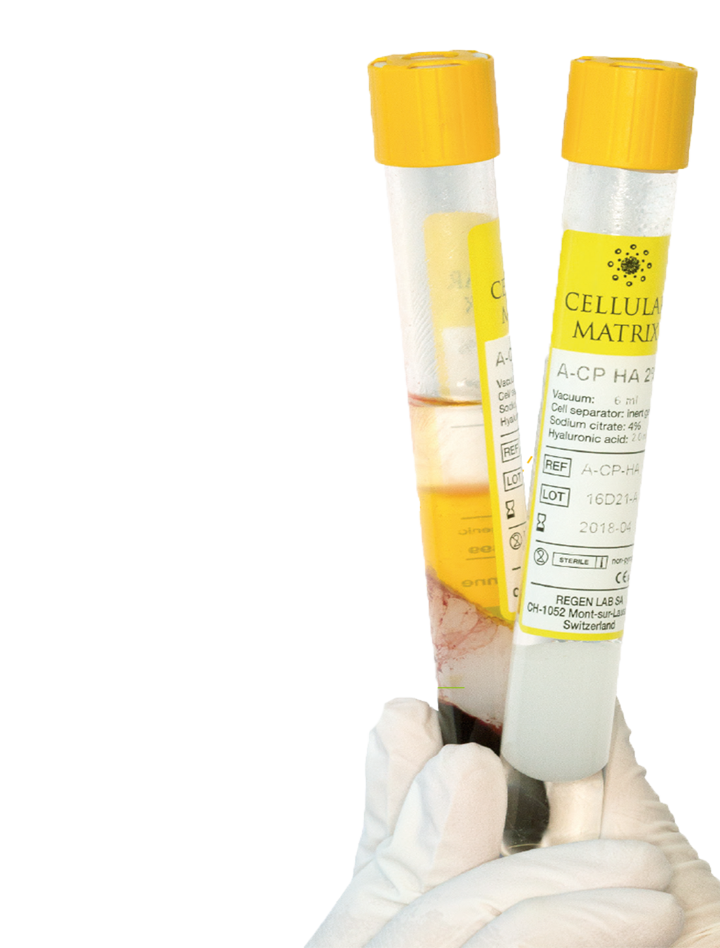 CM Tube