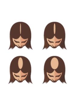 Newsletter10 DE_140422 alopezie