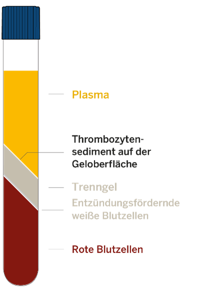 grafik regenkit