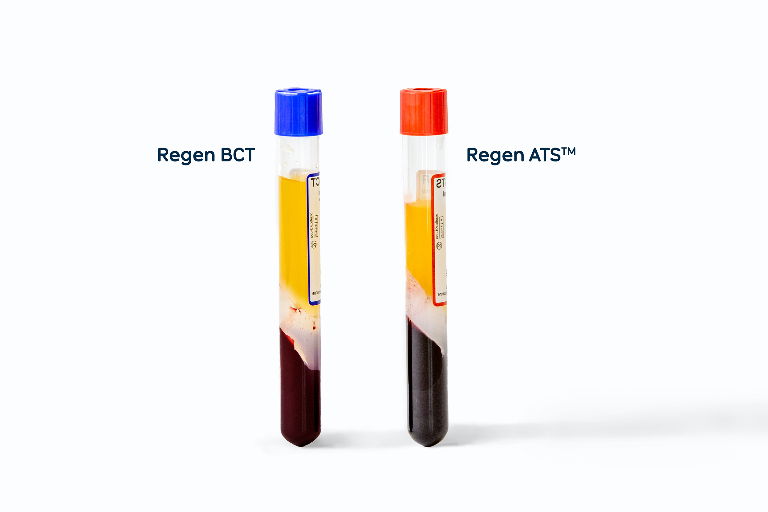 ATS_und_BCT_außeinander_Beschriftung